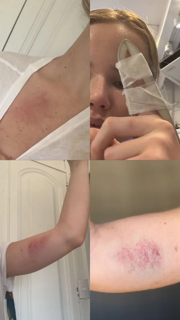 Marcela Tomaszewski desiste de denunciar Dado Dolabella por agressão Marcela Tomaszewski desiste de denunciar Dado Dolabella por agressão