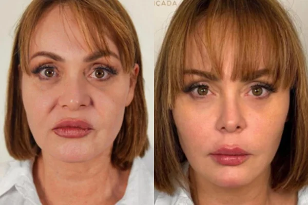 Gaby Spanic choca com nova aparência após sair de A Fazenda 17. Veja